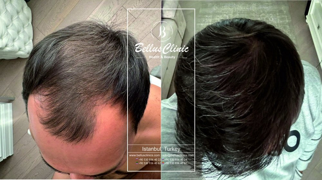 Slider image (4) Bellus Clinic